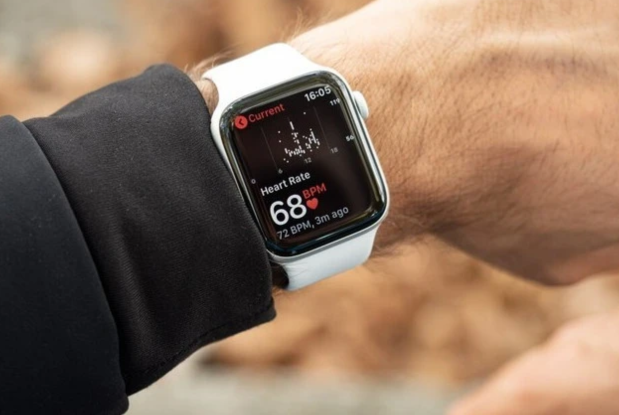 苹果新款Apple Watch开发图曝光 将含血糖传感器